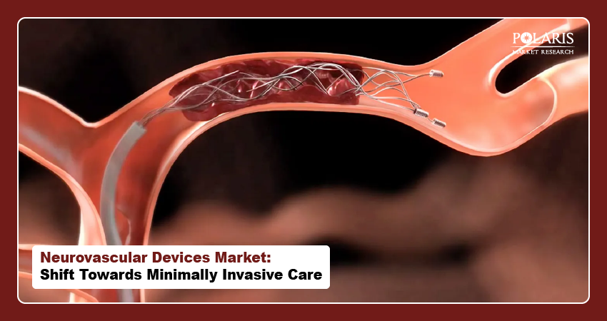 Neurovascular Devices Market: Shift Towards Minimally Invasive Care